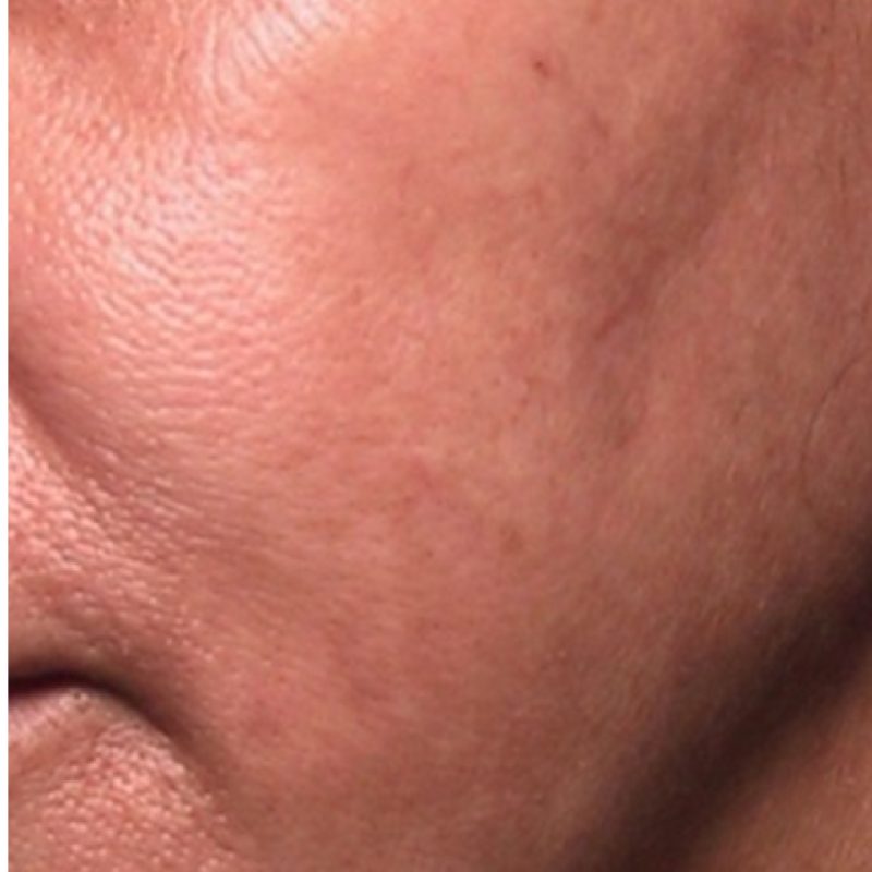 Check-_Asian-skin_after-01.jpg