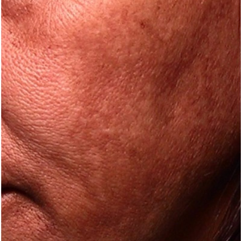 Check-_Asian-skin_before-01.jpg
